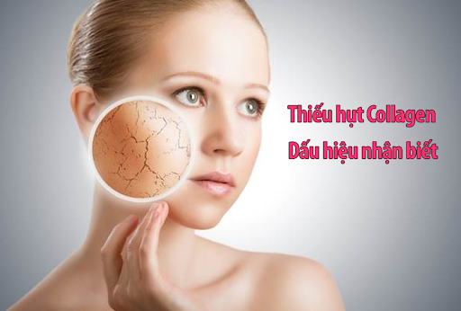 Nguyên nhân gây thiếu hụt collagen và cách khắc phục